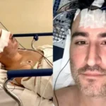Tras la preocupación generada en redes sociales, el vocalista informó que ya se encuentra en casa completando su proceso de recuperación